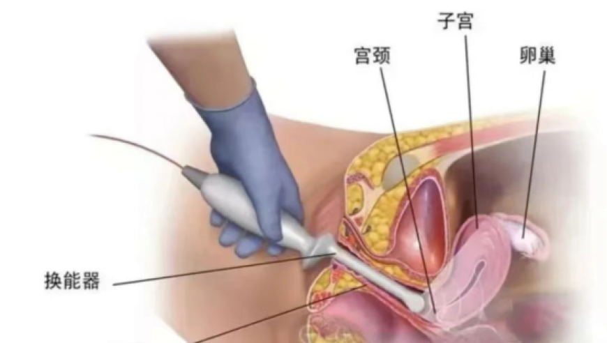 炸裂真人调解节目盘点,澳门六开奖结果查询最新2025年,多元化方案执行策略_增强版V1.53